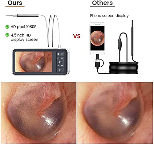 Generico Otoscopio Digitale con Schermo HD e luci LED, Telecamera Auricolare Ricaricabile per Adulti, Bambini e Animali Domestici.