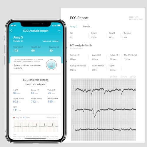 Choicemmed MD100A1-F Handheld Ecg Monitor thumb #6