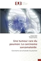 Une tumeur rare du poumon: Le carcinome sarcomatoide 6203452475 Book Cover