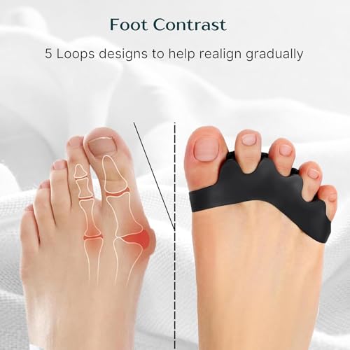 Image of Wonder Care Silicone Toe Separator For Feet Gel Pads Big Toe Corrector Bunion Straightener Yoga Stretcher Hammer Bunion [Black,Pair of 2-4 Pieces]
