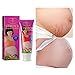 AICHUN BEAUTY Stretch Marks Cream Snail Extract Reduce Skin Scars Remove Damaged Skin Cells 120g/4.23oz