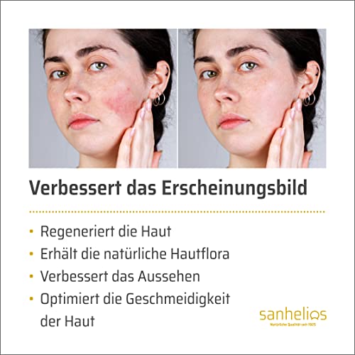 Couperose-Creme Sanhelios für die Behandlung von Rosacea