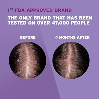 Women's Rogaine 2% Minoxidil Topical Solution for Hair Thinning and Loss, Topical Treatment for Women's Hair Regrowth, 3-Month Supply, Unscented