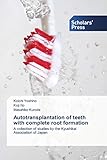 Autotransplantation of teeth with complete root formation: A collection of studies by the Kyushikai Association of Japan