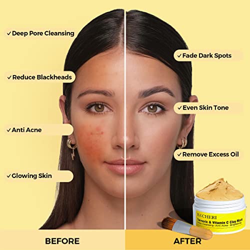 Bacheri Turmeric Vitamin C Clay Mask, Blackheads Acne Dark Spots Remover With Turmeric Extract, Turmeric Healing Clay Mud Mask For Glowing Skin, Refining Pores And Controlling Oil #TOP3