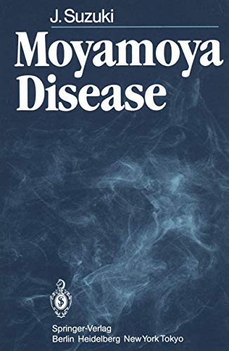 Moyamoya Disease view 2