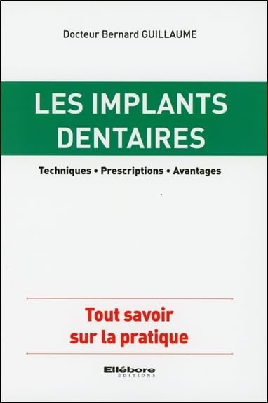 Les implants dentaires - Techniques - Prescriptions - Avantages