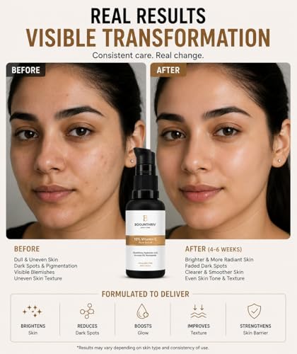 Image of 10% Vitamin C Face Serum with Glutathione, Hyaluronic Acid, Avocado Oil and Niacinamide, 30 ml