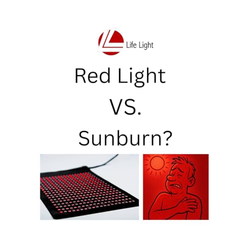 Red light on a sunburn?