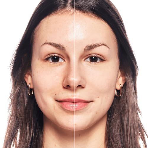 essence CAMOUFLAGE+ HEALTHY GLOW concealer, Nr. 10, Nude, mit Vitaminen, aufhellend, natürlich, strahlend, vegan, wasserfest, ohne Alkohol, ohne Parabene, 1er Pack (5ml)