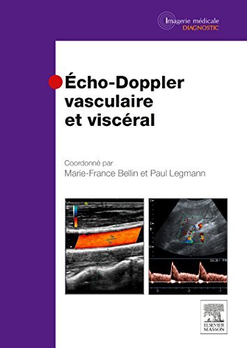 Télécharger Echo-doppler Vasculaire et Visceral by Bellin Marie-france PDF Ebook En Ligne
