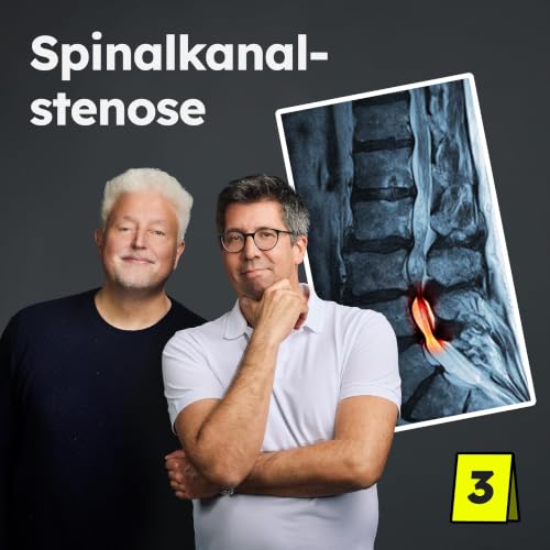Spinalkanalstenose: Schwere, m&uuml;de Beine beim Gehen