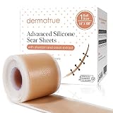 Advanced Silicone Scar Sheets with Allantoin and Onion Extract - 150" x 1.6" Extra Long Scar Tape Fo