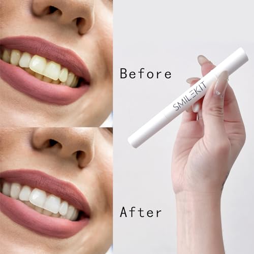 Image of Portable Teeth Whitening Pen (2 Count) - Easily Removes Stains, Effective, Painless, Non-Irritating, and Travel-Friendly.