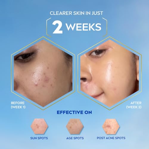 Image of NIVEA Luminous Even Glow Oil Control Face Creme & Moisturiser Serum | Patented Thiamidol (60X More Effective Than Vitamin C) | Salicylic Acid & Hyaluronic Acid | Dark Spots & Pigmentation Serum for Oil Control, Brightening & Hydration | 10ml