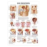 Rüdiger Die Prostata Lehrtafel Anatomie 100x70 cm medizinische Lehrmittel