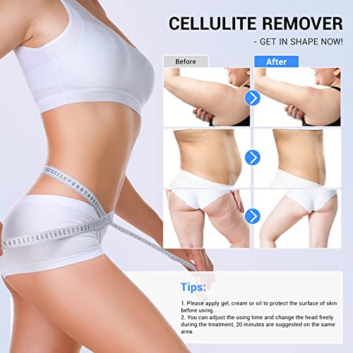 Meiqier G05-0119-2 Sens For Improvement In The Appearance Of Cellulite Device Cellulite Massager Radio Frequency thumb #2