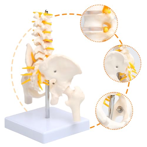 Image of Lumbar Column Spinal Model 8.6 inch Sacrum and Spinal Nerves Anatomy Skeleton Model with Pelvis for Medical Student Learning, Research, Teaching Demonstration | Anatomy Skeleton Model, With Pelvis, For Medical Student Learning, Research, Teaching Demonstration
