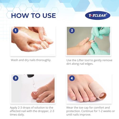 Ingrown Toenail Relief: Ingrown Toenail Tool for Men Women - Ingrown Toenail Removal Kit - Ingrown Toenail Corrector Drops - Ingrown Toenail Removal - Effective Solution for Ingrown Toenails - 30ml