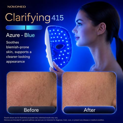 Image of Red Light Therapy for Face - Red Light Mask - 7 Color LED Face Mask Light Therapy - Wireless and Rechargeable Wellness Beauty Device - Lightweight Face Contoured Design