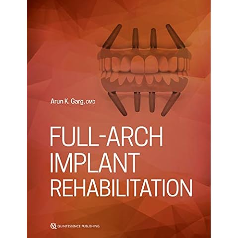 Full-Arch Implant Rehabilitation Cover