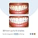 Opalescence GO Home Advanced Teeth Whitening Trays 15% (10 Treatments) Hydrogen Peroxide PF Whitening Prefilled Kit - Developed by Leaders in Professional Whitening 5822-T