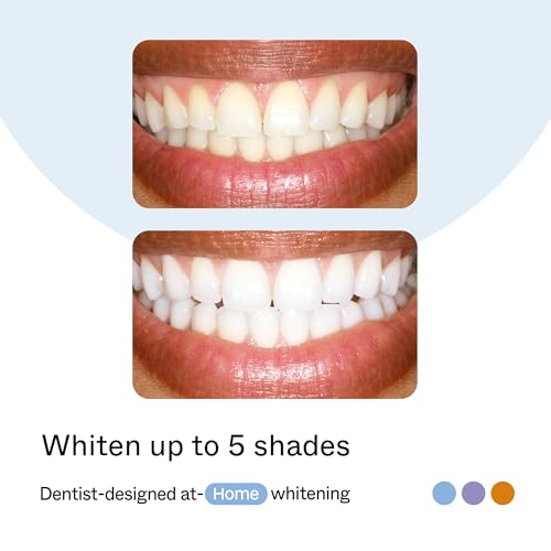 opalescence go home advance gel prefilled teeth whitening trays 15  10 treatments hydrogen peroxide pf teeth whitening kit  enhanced opalescence go trays 5822-t