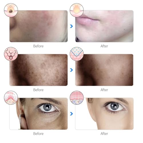 Máscara Led Tratamento Facial Fototerapia Estética 7 Cores