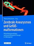 Zerebrale Aneurysmen und Gefäßmalformationen: Behandlungsgrundlagen und neurochirurgische Therapie in Fallbeispielen