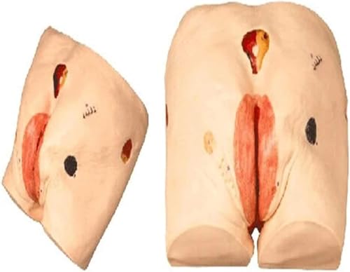 Modèle de soins infirmiers pour escarres et ulcères de décubitus, mannequin d'enseignement médical