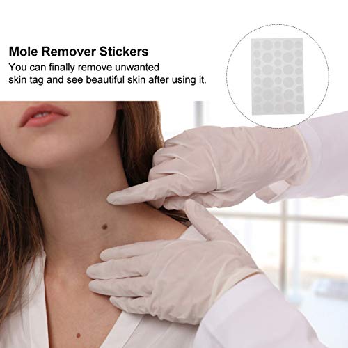 ARTIBETTER 108Pcs Adesivos de Pele E Adesivos de Remoção de Acne Adesivos Removedor de Verrugas Remo