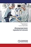 Akusherskie krovotecheniya (Russian Edition)