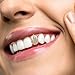 HANABASS Single Tooth Grill Hip Hop Teeth Cap with Pattern Gold Plated Fashion Accessory for Men and Women Concert Party Mouth Bling