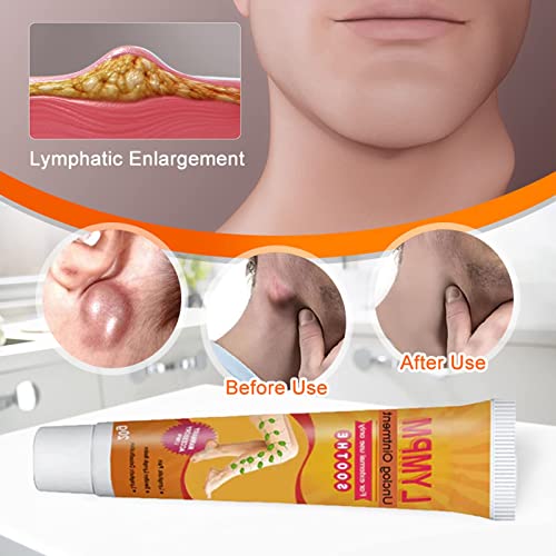 Oitto Mediginger Anti Swelling Lympunclog Ointment, Herbal Anti Swelling Lympunclog Ointment, Mediginger Lympunclog Ointment For Legs, Gingerlegs Anti Swelling Ointment (2 Pcs) #TOP1
