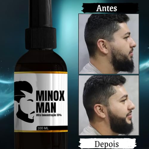 Tonico Para Crescimento Capilar Barba E Cabelo 100ml Minoxman