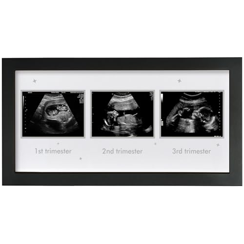 Image of HAMUIERS Ultrasound Picture Frame - Triple Sonogram Frame for Mom to Be | Pregnancy Photo Album Decor | Baby Nursery Essentials & Gender Reveal Gifts | First Trimester Keepsake & Pregnancy Must Haves, Black1