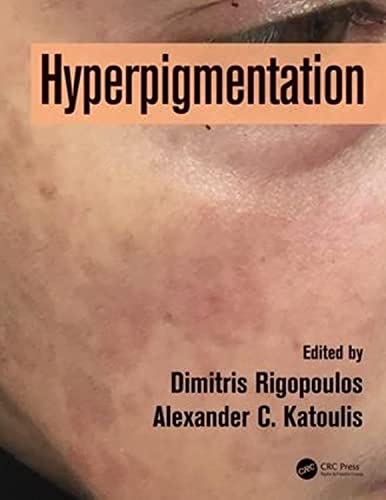 Hyperpigmentation (Hb 2018) view 2
