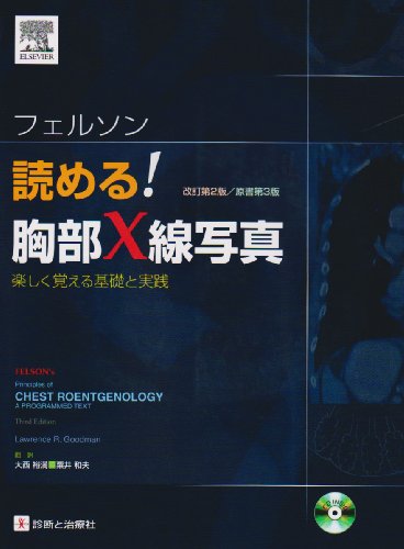 無料電子書籍 おすすめ フェルソン読める!胸部X線写真―楽しく覚える基礎と実践 バイ