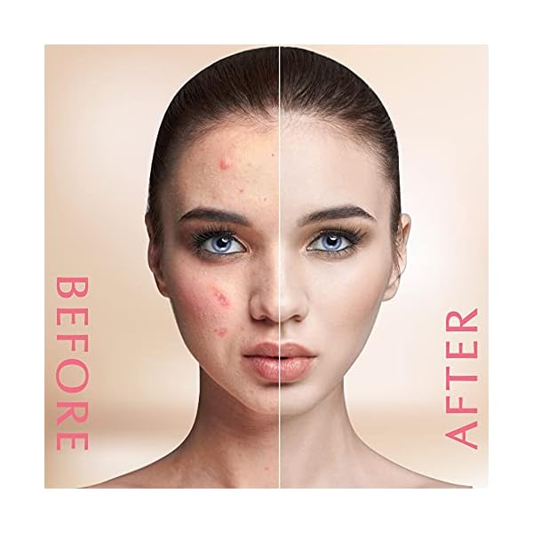 Dark-Spot-Remover-Corrector-for-Face-Body-Dark-Spot-Melasma-Hyperpigmentation-Sunspots-Treatment-Advanced-Ingredients-Kojic-Acid-Salicylic-Acid-Azelaic-Acid-and-Vitamin-C Dark Spot Remover Corrector for Face & Body - Dark Spot, Melasma, Hyperpigmentation & Sunspots Treatment - Advanced…