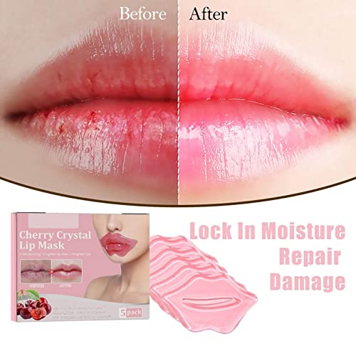 Cherry Lip Mask 5 Pack Collagen Crystal Gel Lip Care Masks, Moisturizing Lips Essence For Firms Hydrates Lips, Anti Chapped & Anti-Aging, Reduces Lip Lines, Remove Dead Skin #TOP3