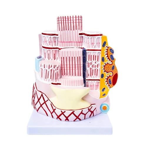 �m�[�u�����h�i �l�̍��i�ؑ@�ۉ�U�w���ރ��f���A4���{�g�僂�f���A�R���[�Q�����b�V���@�ېl�̍��͌^ ����p