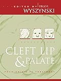 Cleft Lip and Palate: From Origin to Treatment
