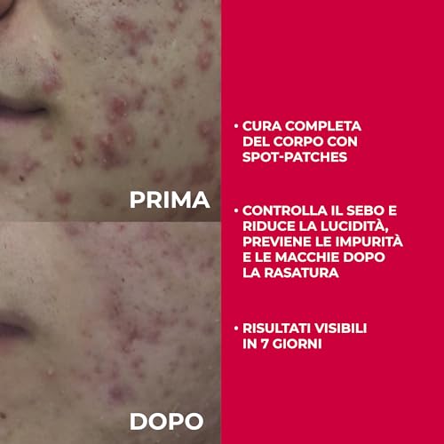 Biotrade Acnaut Lozione Attiva Per Pelle Grassa Con Tendenza A Sfoghi, Riduzione Dei Pori Dilatati E Ostruiti - 9