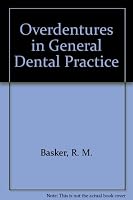 Overdentures in General Dental Practice 0904588203 Book Cover