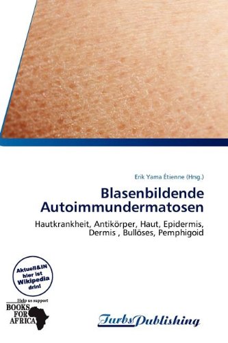 Blasenbildende Autoimmundermatosen: Hautkrankheit, Antikörper, Haut, Epidermis, Dermis , Bullöses, Pemphigoid