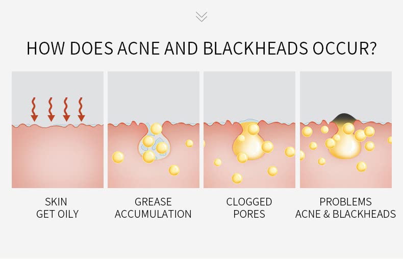 Miniatura 5 de Máscara de arcilla de poros de frijol mungo (0.18 oz* 12 paquetes) Máscara de lavado para el cuidado de puntos negros y puntos blancos Limpiar y