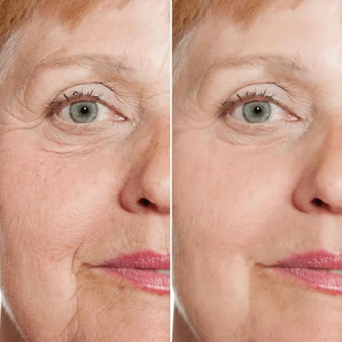 3PCS：MSGBcg Ageless Rejuvenate Face Serum，Instant Face Lift & Anti Wrinkle Firming Serum for Reduce Wrinkles - Fine Lines - Plumping Skin，12% Vitamin c + 1% Hyaluronic Acid Formula for All Skin Types — view 3