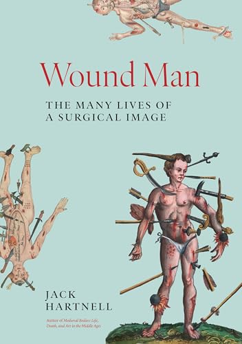 Wound Man: The Many Lives of a Surgical Image