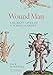 Wound Man: The Many Lives of a Surgical Image