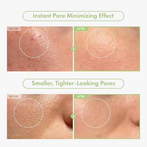 Image of TOSOWOONG Green Caviar Pore Ampoule for Pore Care, Firming, Hydrating
